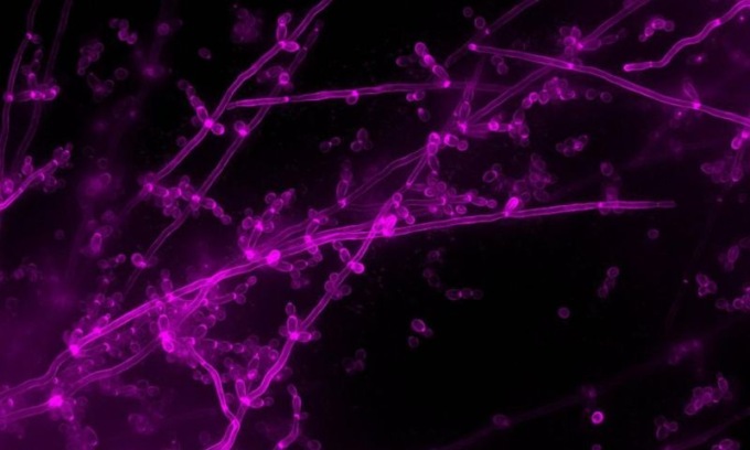Da Unimore importante studio su una patologia che colpisce tre quarti delle donne